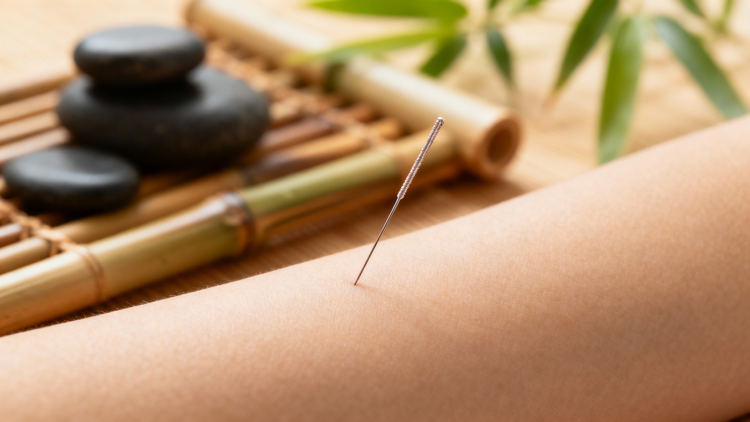 Featured image for Finding Balance: Harnessing Acupuncture for Psoriasis Relief